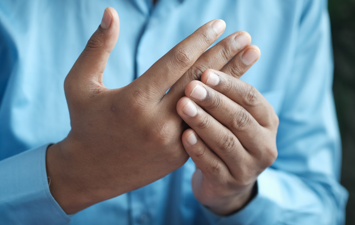 Close up of a pair of hands. One hand is stiff and appears to be in pain